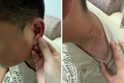 八字看从弱格:在线测算运势www.jixiangqiming.vip：-特教老师殴打自闭症学生，被拘留10日后返岗，家长要求开除，校方回应